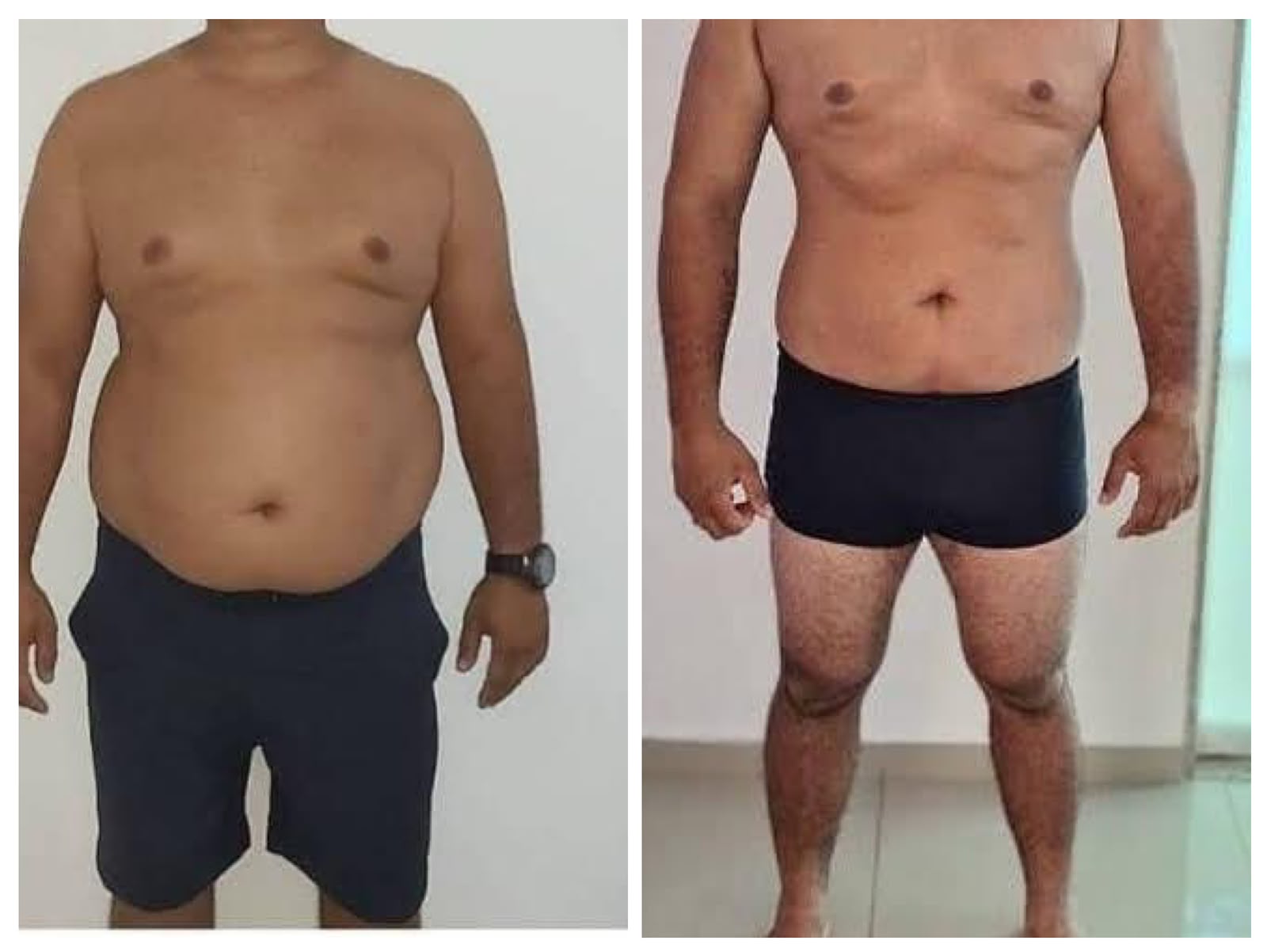 Registro fotográfico de evolução corporal na região abdominal